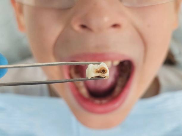 Best 24-Hour Emergency Dental Care in Shoh, IL